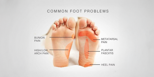 A Clinical View on Specialized Footwear for Pain Relief