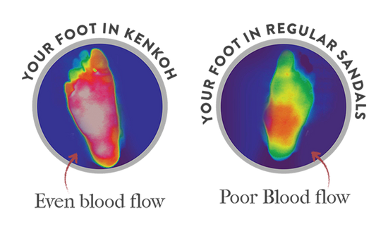 Reflexology Sandals vs Regular Sandals: What's Actually Different?